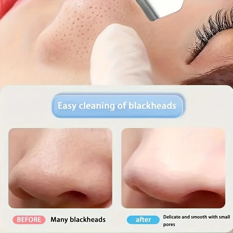 Double-Ended Blackhead Remover Tool